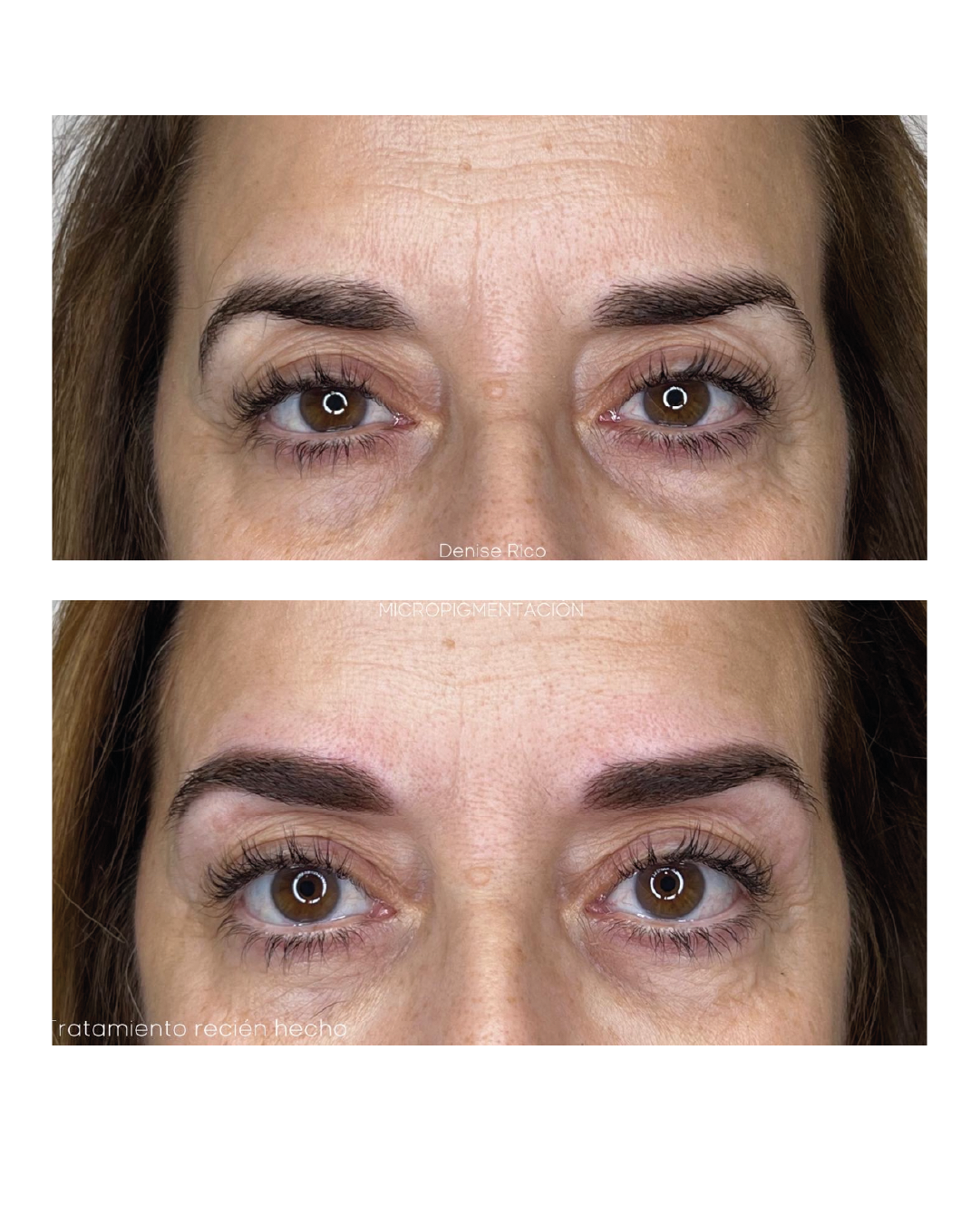 Micropigmentación Madrid